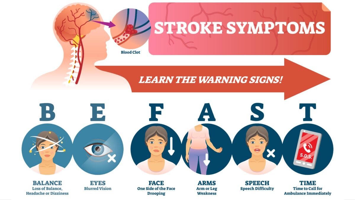 Alameda Post - a graphic for BE FAST, the acronym to identify strokes