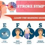 Alameda Post - a graphic for BE FAST, the acronym to identify strokes