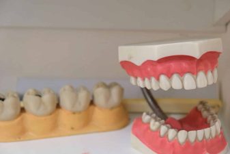 Alameda Post - a model of teeth